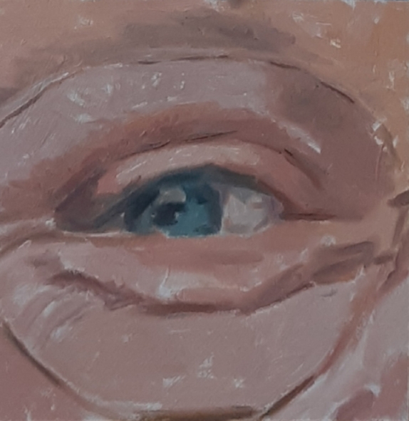 "It is eye 1"
